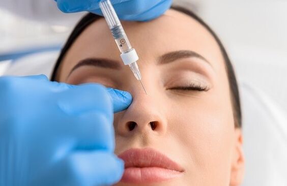 Metoda nesirurške rinoplastike