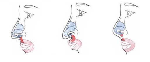 Odrezovanje dela nosne mišice