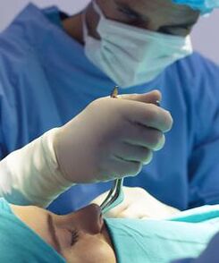 izvajanje zaprte plastične operacije nosu